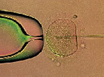 Московским клиникам запретят подсаживать более двух эмбрионов при ЭКО